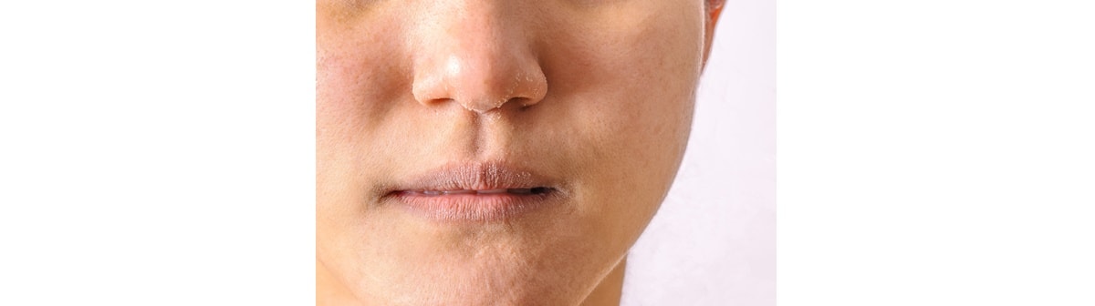 Hidratante para pele seca: benefícios e como escolher?