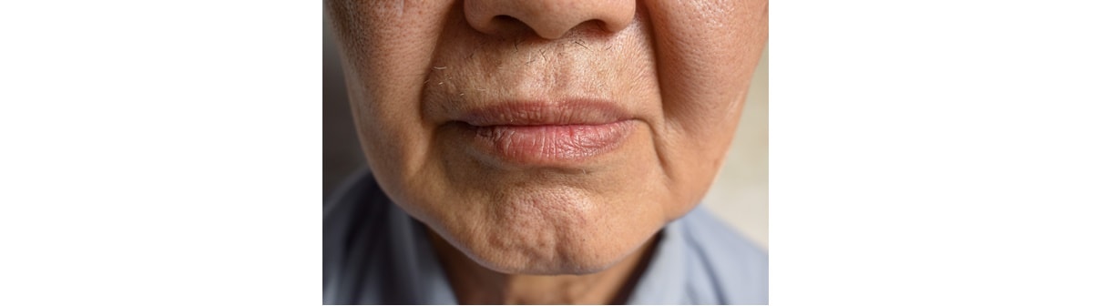 Região inferior do rosto com a pele envelhecida e com bigode chinês