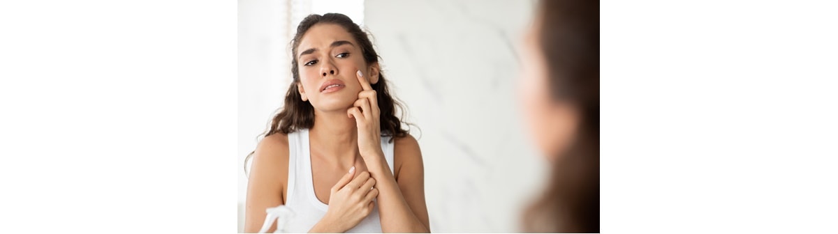 Veja como cuidar da pele após espremer uma espinha
