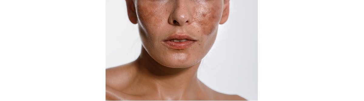 Skincare: como criar uma rotina eficiente? Veja dicas e truques