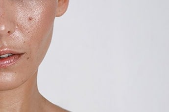 Pele oleosa: quais as características e como tratar?