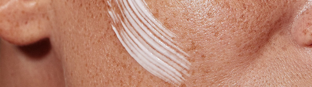 mulher de pele clara com sarda usando creme facial