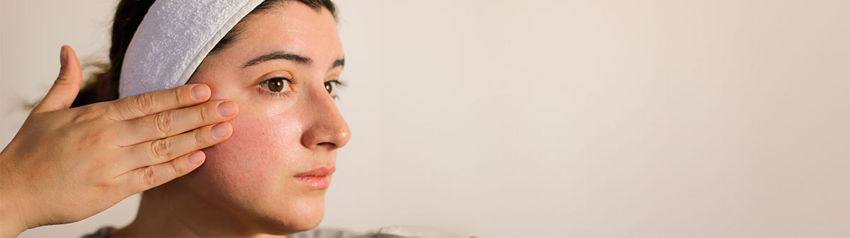 mulher com pele clara com sensibilidade pós tratamento de peeling