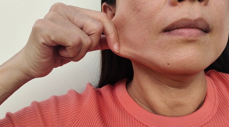 Mulher estica sua pele com flacidez no rosto