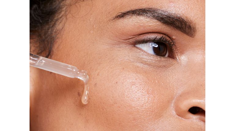 Jovem mulher brasileira aplica o sérum de vitamina c na pele do rosto para tratar e prevenir manchas escuras na pele