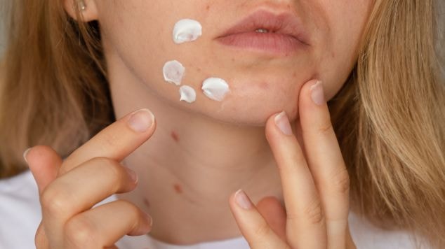 Jovem aplica tretinoína, ou ácido retinóico, na pele do rosto