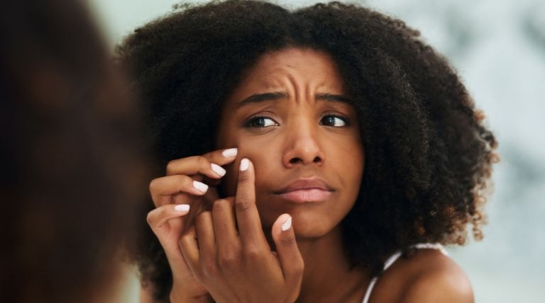  Jovem negra avaliando a necessidade de usar um creme para espinhas e cravos no rosto