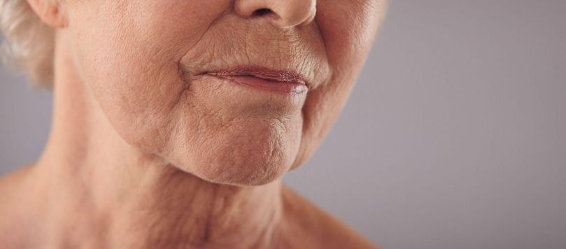 Close-up do rosto e pescoço de uma mulher idosa evidenciando sinais de envelhecimento da pele, como rugas e flacidez na região do queixo e pescoço.