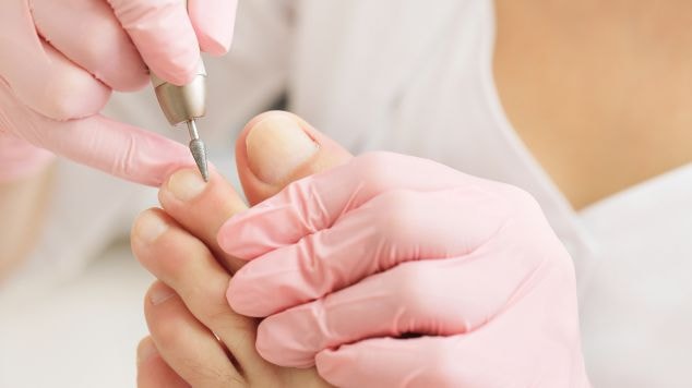 Profissional trata da pele do pé de cliente que teve micose ou frieira, que também pode acometer outras áreas do corpo.