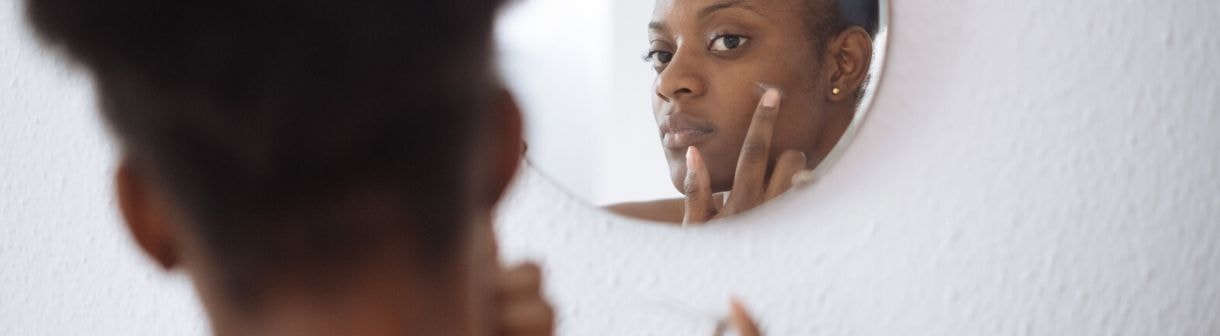 Como limpar o rosto com cravos e espinhas