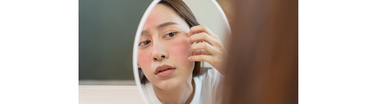 Queimaduras de sol: como cuidar e evitar