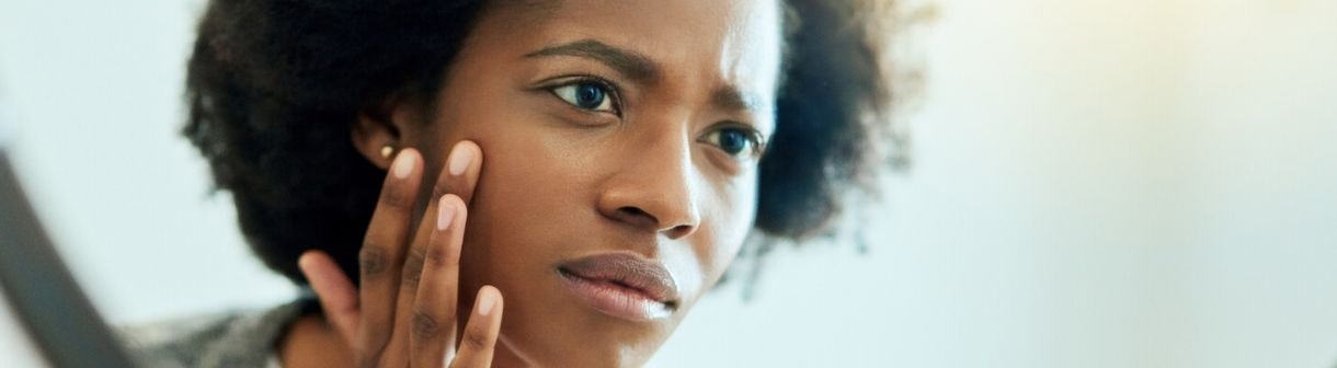 Manchas na pele: 4 coisas que podem causar essas marcas