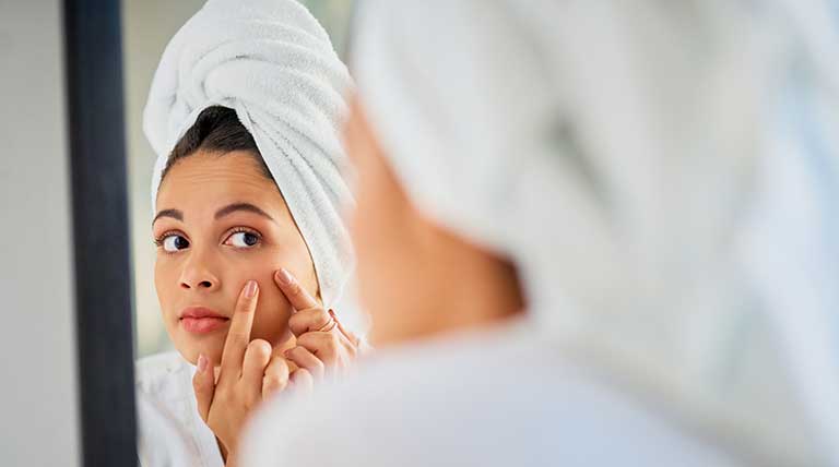 O que causa as manchas de acne?