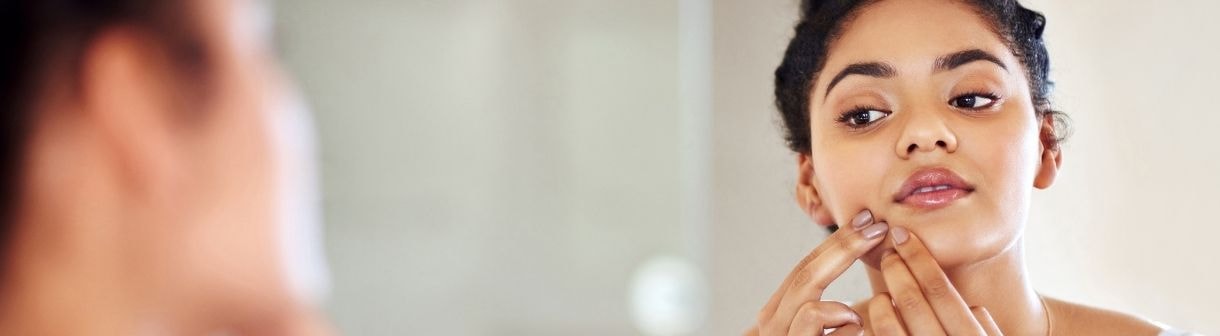 Meu hidratante facial está causando espinhas: o que pode ser? Entenda as causas desse tipo de acne