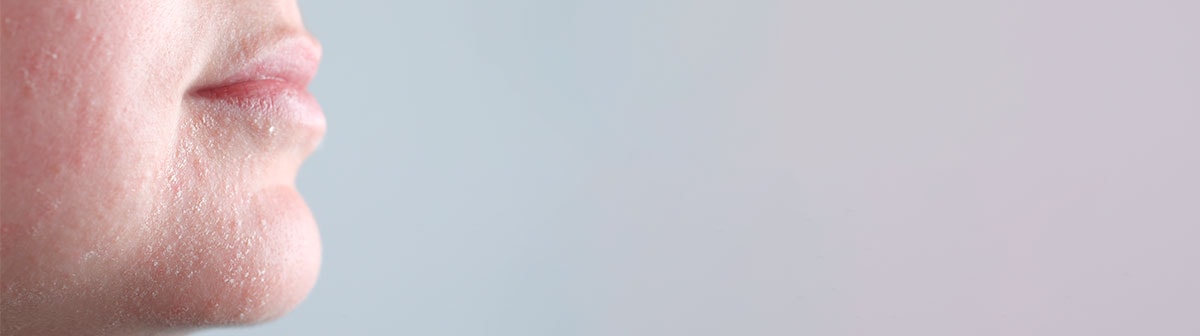 Pele ressecada: o que causa e como tratar?