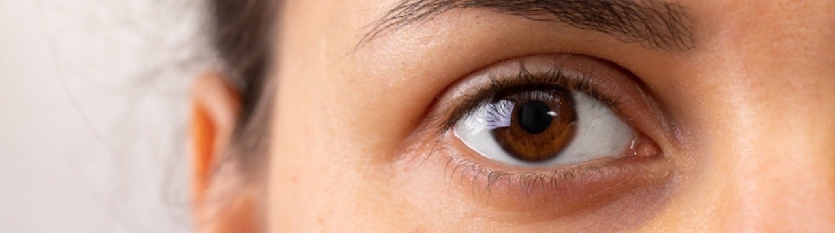 como desinchar o olho