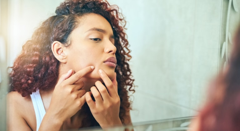 Vitamina_C_pode_dar_espinhas768x420