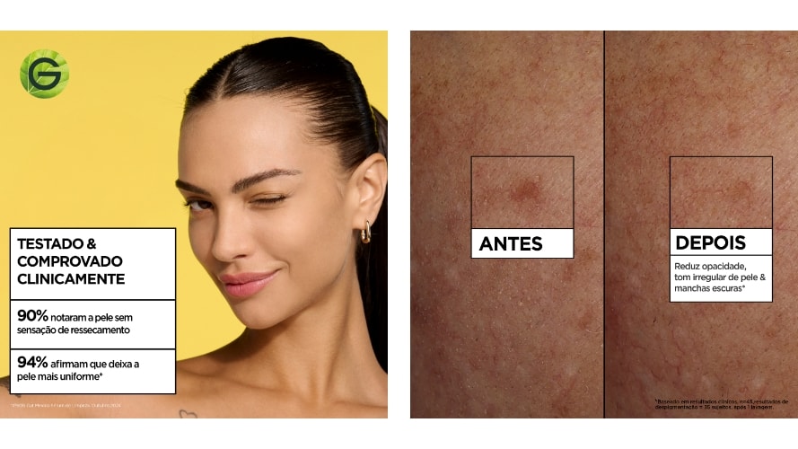 Testado e comprovado; Diminuição de mancha após uso. Imagem do antes e depois.