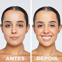 Protetor Hidratante Com Cor Média | Antes e Depois | Garnier